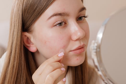 Young woman applies a hydrocolloid acne patch to her cheek, showing modern skincare, blemish treatment, and selfcare routine for clear, healthy skin. photo