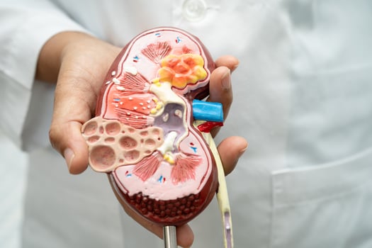 Kidney disease Chronic kidney disease ckd, Doctor hold human model to treat study photo