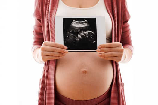 Unrecognizable pregnant woman holding her baby sonography shot near naked belly while standing against window at home, expectant mother enjoying first photo of her unborn child, closeup image, cropped