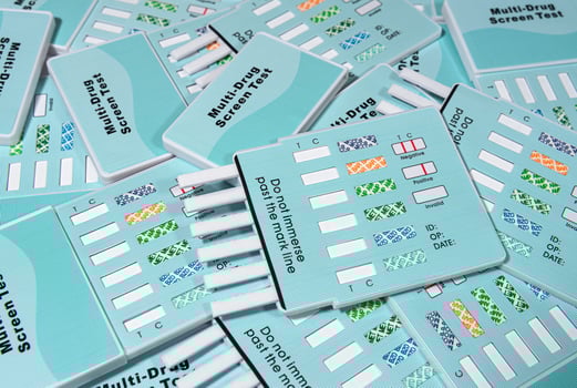 Urine drug screen test panels close up photo