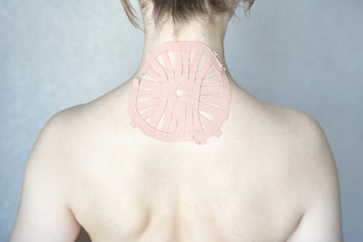 Female adult caucasian back with therapeutic tape applied for pain relief and muscle support. photo