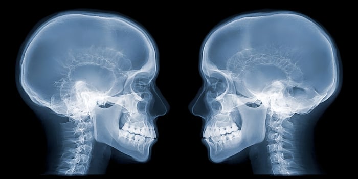 Two Human Skulls XRay Side Profile Facing Each Other Medical Anatomy Image photo