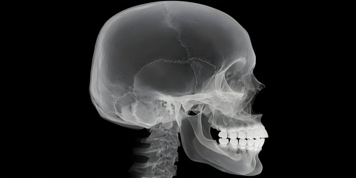 Human Skull XRay Side View Detailed Anatomy Image photo
