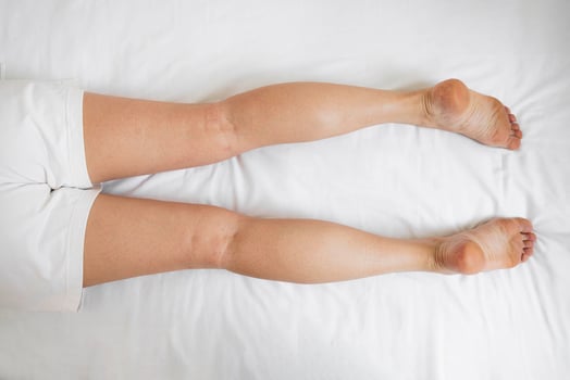 top view of adult woman legs on medical bed, visible signs of leg swelling, skin changes, concept of chronic venous insufficiency, lymphedema, post-surgical recovery, diagnostic evaluation photo