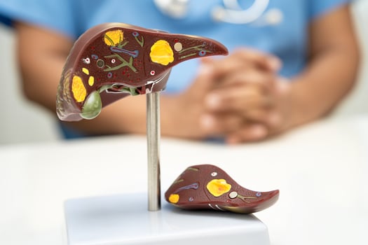 Cirrhosis, Liver cancer, fatty liver, Asian doctor with liver human anatomy photo
