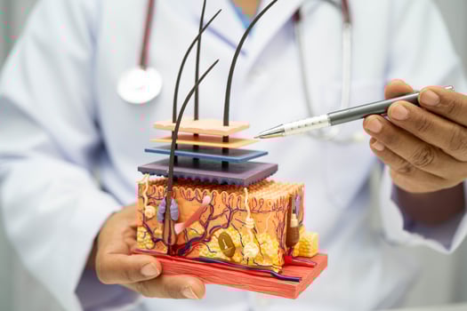 Hair transplant Asian dermatologist doctor holding skin structure anatomy model for treatment in hospital. photo