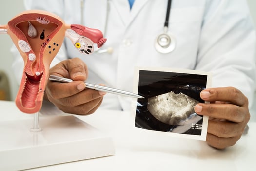 Uterus doctor with anatomy model for study diagnosis and treatment in hospital. photo