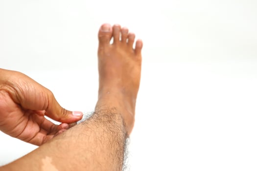 Close-up of a person's leg and foot against a white background showing skin and hair photo