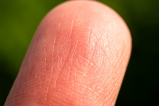 Close-up finger texture nature setting macro detailed view skin patterns photo