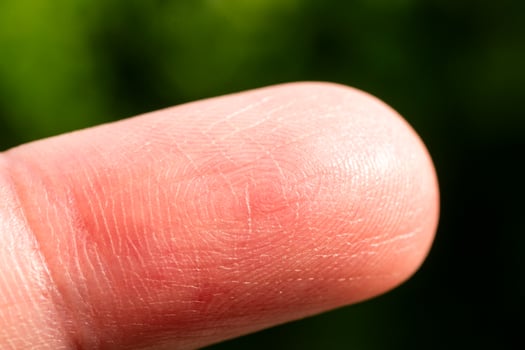 Close-up finger tip macro in nature green background textured skin detail photo