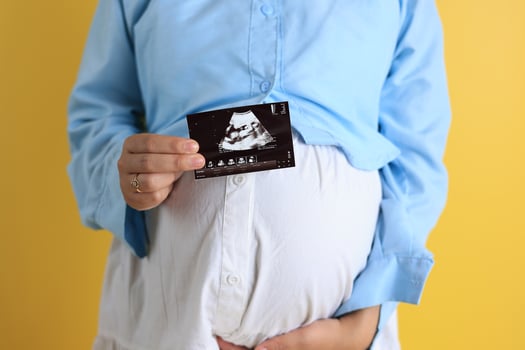 Pregnant Woman with Ultrasound Picture on Yellow Background photo