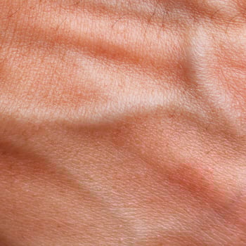 human tan skin texture with blood vessel and hair photo