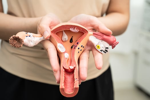 Uterus woman human anatomy model. photo