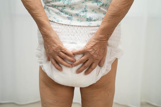 woman patient wearing adult incontinence diaper pad in hospital. photo