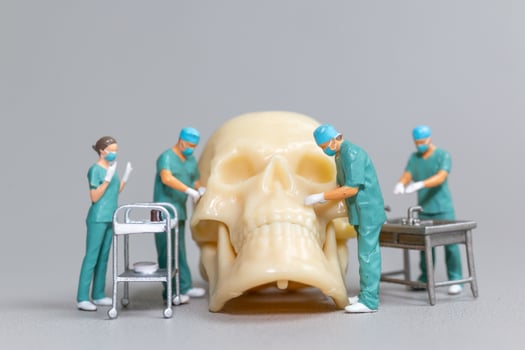 Miniature Surgeons Operating on Human Skull Model photo