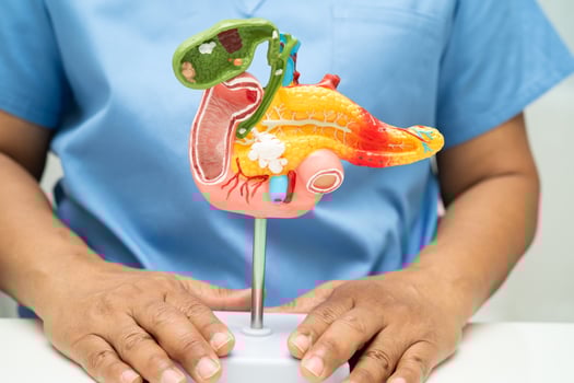 Pancreatitis pancreatic cancer, Asian doctor with pancreas, gallbladder bile duct human photo