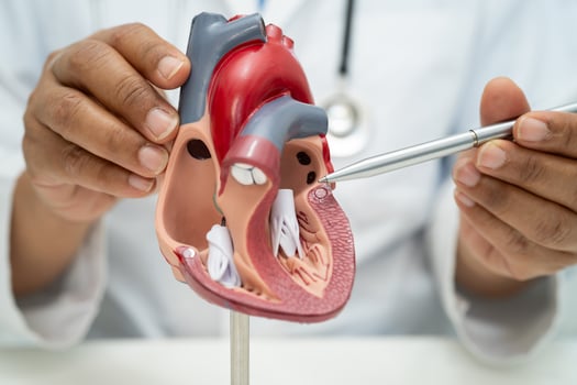 Cardiovascular disease CVD, Asian doctor holding human anatomy model for treat heart photo