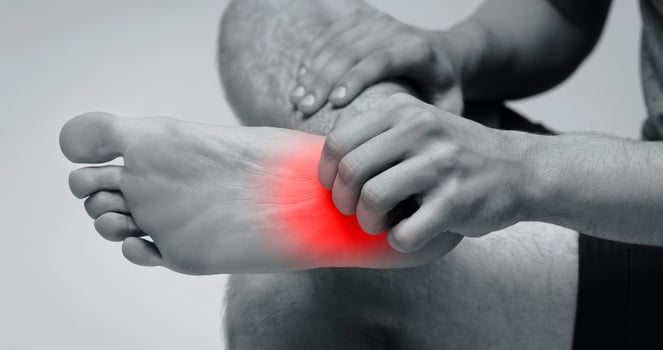 Man scratching itch on his foot with red rash. Cause include athlete's foot , fungal infection, dermatitis , eczema, psoriasis, or bug bites, monochrome photo