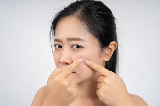 Asian woman squeezing pimples on her face, skin care lifestyle concept. photo