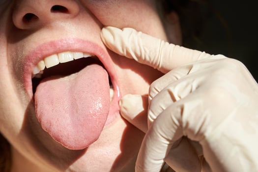 Close-up of female mouth with tongue out and gloved hand examining inside oral health check. photo
