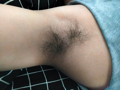 A hairy man's arm photo