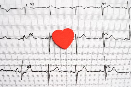 Electrocardiogram ECG heart wave, heart attack cardiogram photo