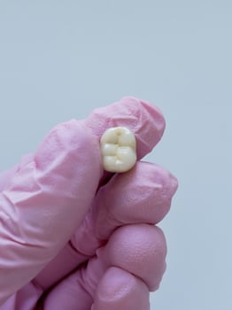 Tooth held by gloved hand on light gray background. Macro image of a human molar held by fingers in a pink medical glove. photo