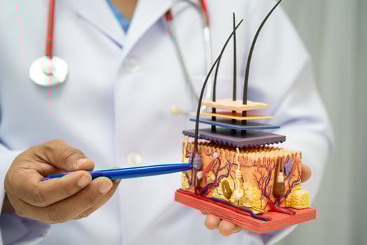 Hair transplant, Asian dermatologist doctor holding skin structure anatomy model for treatment photo
