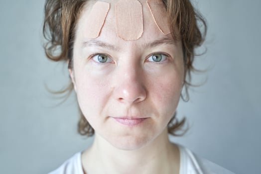 Caucasian young adult female with bandages on forehead looking forward, soft lighting and neutral expression. photo