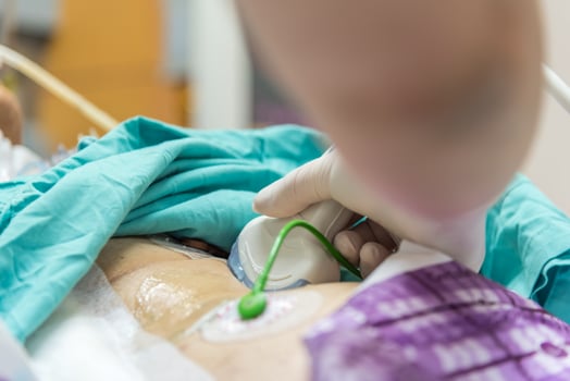 A person in a hospital bed with a green device photo