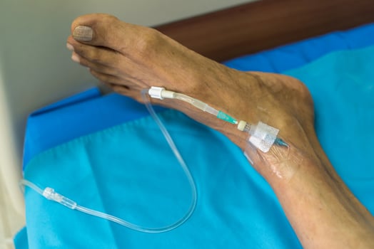 A person with an iv in their foot photo