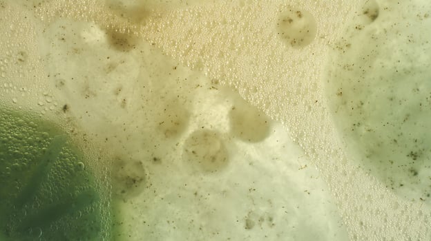 Microscopic World Of Bubbles And Particles With Green Hues. photo