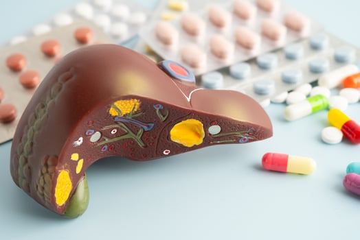 Liver model with pill drug treatment, Cirrhosis, Liver cancer photo
