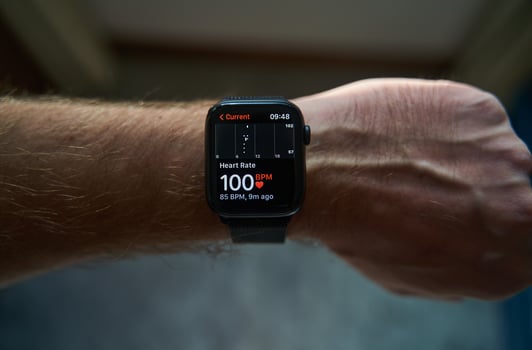 Belgrade, Serbia - 06.09.2022. A square smartwatch on a man's hand close up. Heart rate measurement on watch photo