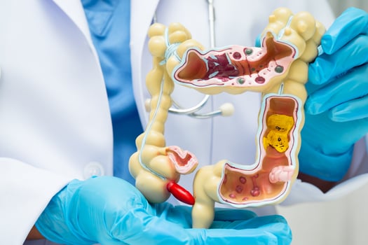Intestine, doctor holding human anatomy model for study diagnosis and treatment in hospital. photo