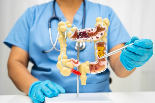 Intestine, Asian woman holding human anatomy model. photo