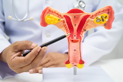 Uterus, doctor holding human anatomy model for study diagnosis and treatment in hospital. photo