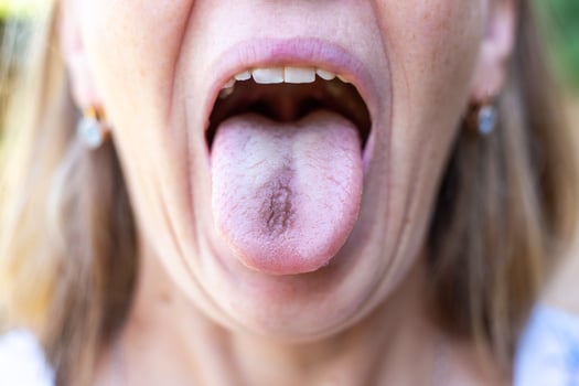 Open female mouth with blue tongue inside. Tongue coloring photo