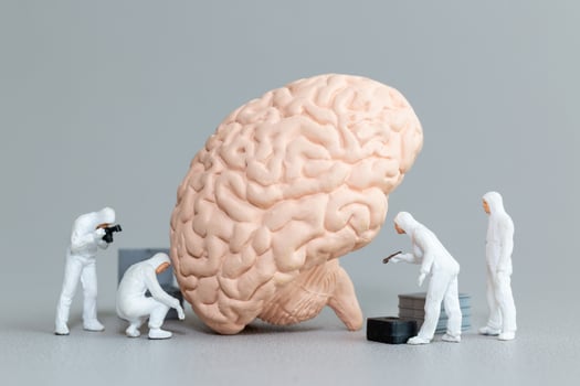 Miniature figures in hazmat suits inspect and analyze a giant brain model photo