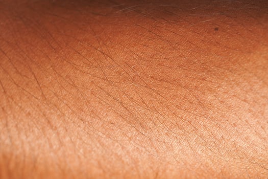 Close-up view of textured skin under natural light photo