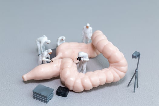 Tiny figures in hazmat suits examine a model of the human intestine photo