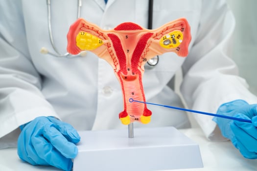 Doctor holding human uterus model for vaginal and cervix pap smear check up in the obstetrics and gynecology. photo