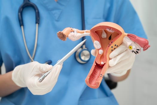 Uterus, doctor holding human anatomy model for study diagnosis treatment photo