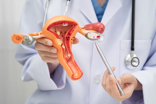 Uterus, doctor holding human anatomy model for study diagnosis photo