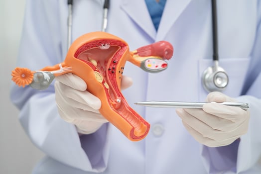 Uterus, doctor holding human anatomy model for study diagnosis and treatment in hospital. photo