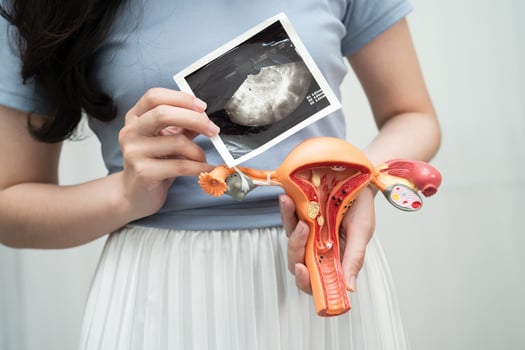 Uterus ultrasound, Asian woman holding human anatomy model. photo