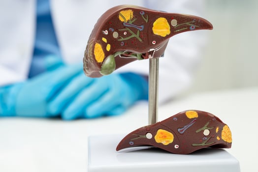 Cirrhosis, Liver cancer, fatty liver, Asian doctor with liver human anatomy model World Hepatitis Day photo
