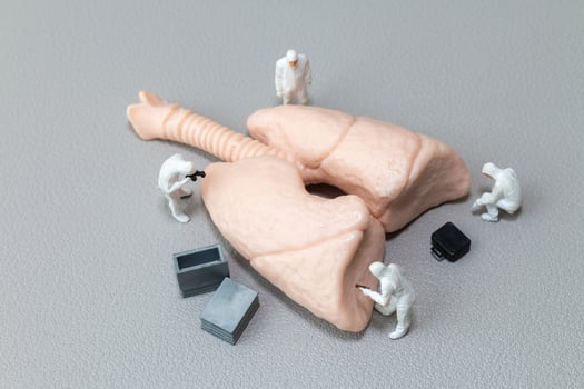 Tiny hazmat-suited figures examine a human lung model, representing respiratory health photo