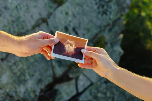 Couple holding ultrasound scan of their baby, pregnancy and parenthood concept photo