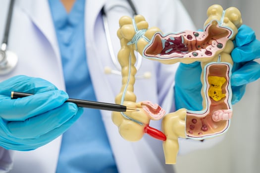 Intestine, doctor holding human anatomy model photo